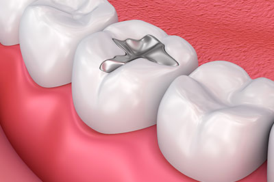 Douglas F. Geiger, DMD, PLLC | Dental Lab, Emergency Treatment and Periodontal Treatment