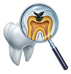 Douglas F. Geiger, DMD, PLLC | Oral Exams, Dentures and Dental Cleanings