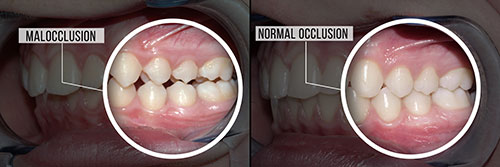 Douglas F. Geiger, DMD, PLLC | Root Canals, Full Mouth Reconstruction and Dental Bridges
