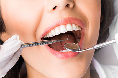 Douglas F. Geiger, DMD, PLLC | Dental Fillings, Implant Restorations and Night Guards