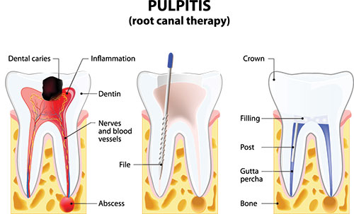 Douglas F. Geiger, DMD, PLLC | TMJ Disorders, Dental Sealants and Dentures