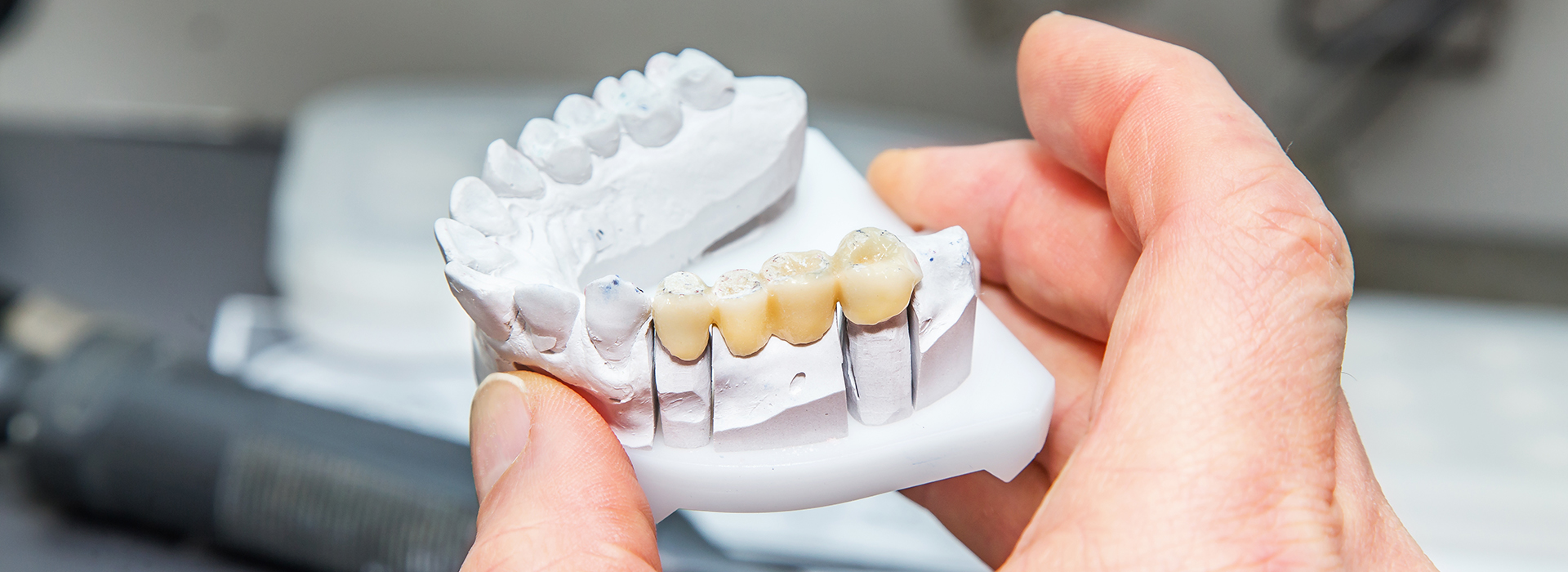 Douglas F. Geiger, DMD, PLLC | Extractions, ClearCorrect reg and Oral Exams