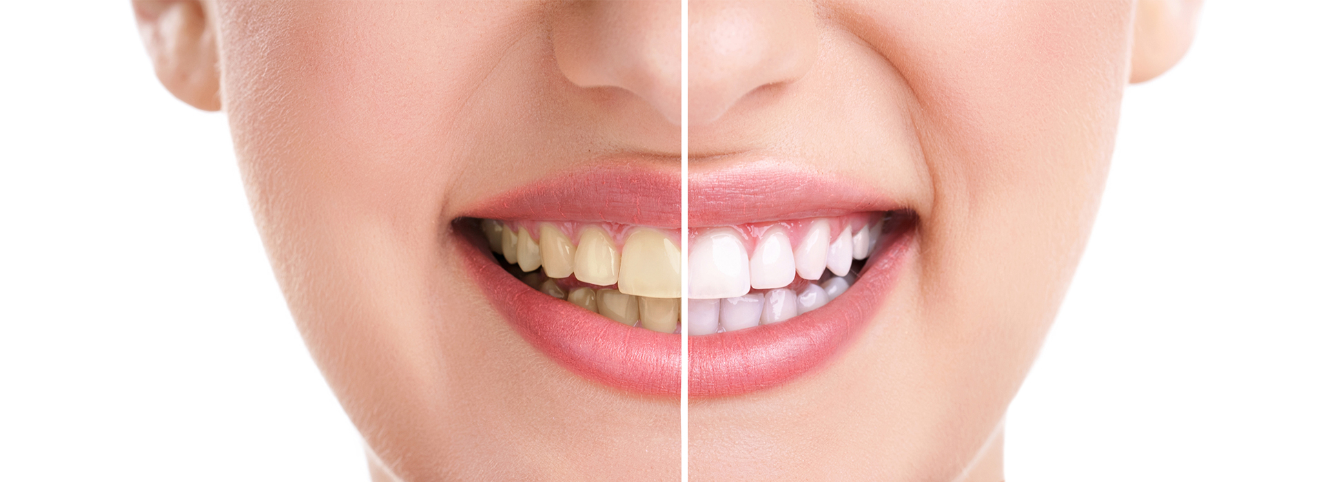 Douglas F. Geiger, DMD, PLLC | Dental Cleanings, Periodontal Treatment and Night Guards