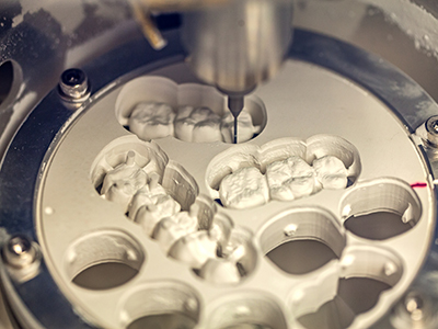 Douglas F. Geiger, DMD, PLLC | Dental Bridges, ClearCorrect reg  and Full Mouth Reconstruction